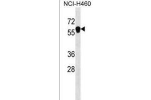 ANKDD1B Antibody (C-term) (ABIN1537327 and ABIN2850198) western blot analysis in NCI- cell line lysates (35 μg/lane). (ANKDD1B 抗体  (C-Term))