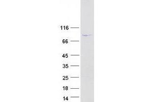 Validation with Western Blot (Dynein Regulatory Complex Subunit 1 (DRC1) protein (Myc-DYKDDDDK Tag))