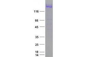 Western Blotting (WB) image for Neurofilament, Heavy Polypeptide (NEFH) protein (Myc-DYKDDDDK Tag) (ABIN2727127)