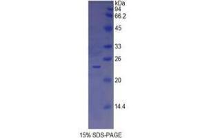 SDS-PAGE analysis of Human Insulin Like Growth Factor Binding Protein 6 (IGFBP6) Protein. (IGFBP6 蛋白)