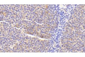 Detection of RANk in Human Lymph node Tissue using Polyclonal Antibody to Receptor Activator Of Nuclear Factor Kappa B (RANk)