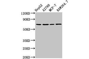 Western Blot Positive WB detected in: HepG2 whole cell lysate, A2780 whole cell lysate, MCF-7 whole cell lysate, RAW264. (PRSS8 抗体  (AA 185-319))