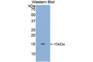 Detection of Recombinant CEA, Human using Polyclonal Antibody to Carcinoembryonic Antigen (CEA) (CEA 抗体  (AA 566-698))