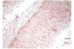 Immunohistochemistry using  polyclonal TNFa antibody showing staining of formalin/PFA-fixed paraffin-embedded sections of human artery tissue sections.