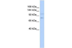 WB Suggested Anti-PTPRH Antibody Titration:  0. (PTPRH 抗体  (Middle Region))