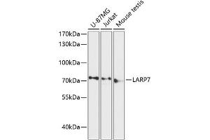 Western blot analysis of extracts of various cell lines, using L antibody (ABIN6128191, ABIN6143096, ABIN6143097 and ABIN6216959) at 1:3000 dilution. (LARP7 抗体  (AA 160-380))