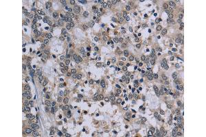 Immunohistochemistry (IHC) image for anti-P53-Regulated Apoptosis-Inducing Protein 1 (TP53AIP1) antibody (ABIN2435142) (TP53AIP1 抗体)