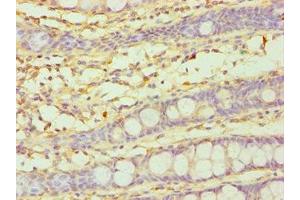 Immunohistochemistry of paraffin-embedded human colon tissue using ABIN7149265 at dilution of 1:100 (CYP3A5 抗体  (AA 233-502))