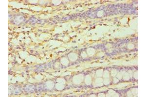 Immunohistochemistry (IHC) image for anti-Cytochrome P450, Family 3, Subfamily A, Polypeptide 5 (CYP3A5) (AA 233-502) antibody (ABIN7149265)