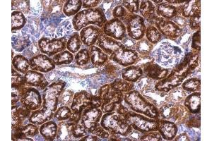 IHC-P Image GDI1 antibody detects GDI1 protein at cytosol on mouse kidney by immunohistochemical analysis. (GDI1 抗体)
