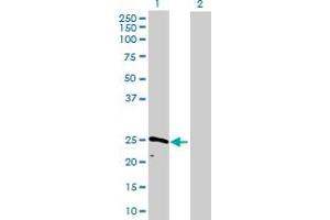Western Blot analysis of CAPNS1 expression in transfected 293T cell line by CAPNS1 MaxPab polyclonal antibody. (Calpain S1 抗体  (AA 1-268))