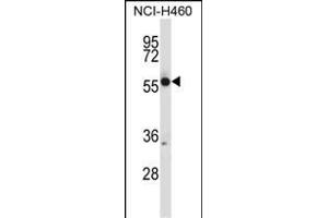 CR Antibody (N-term) (ABIN657682 and ABIN2846674) western blot analysis in NCI- cell line lysates (35 μg/lane). (CRMP1 抗体  (N-Term))