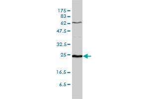 SDF2 monoclonal antibody (M01), clone 3G7-1D6 Western Blot analysis of SDF2 expression in WI-38 . (SDF2 抗体  (AA 20-211))