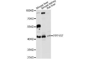 Western blot analysis of extracts of various cell lines, using PPP1R7 antibody (ABIN6293696) at 1:3000 dilution.