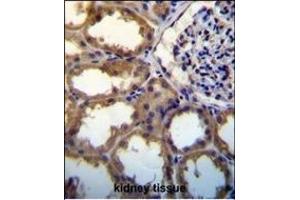 PDGFC antibody (N-term) (ABIN650654 and ABIN2837869) immunohistochemistry analysis in formalin fixed and paraffin embedded human kidney tissue followed by peroxidase conjugation of the secondary antibody and DAB staining. (PDGFC 抗体  (N-Term))
