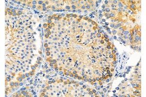 ABIN6264206 and ABIN6279656 at 1/100 staining Mouse testis tissue by IHC-P. (PIGP 抗体  (Internal Region))