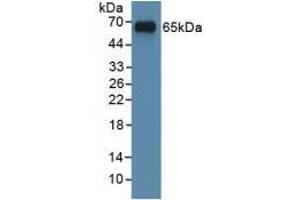 Detection of Recombinant MYC, Human using Polyclonal Antibody to V-Myc Myelocytomatosis Viral Oncogene Homolog (MYC) (LMYC 抗体  (AA 184-454))