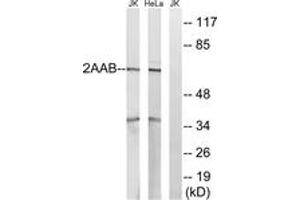 Western blot analysis of extracts from HeLa/Jurkat cells, using PPP2R1B Antibody. (PPP2R1B 抗体  (AA 552-601))