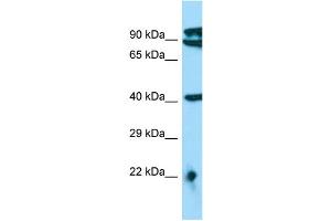 WB Suggested Anti-MTERFD3 Antibody Titration: 1.