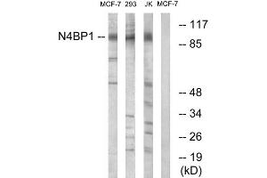 Western blot analysis of extracts from MCF-7 cells, 293 cells and Jurkat cells, using N4BP1 antibody.