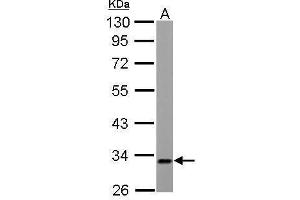 Western Blotting (WB) image for anti-Electron-Transfer-Flavoprotein, alpha Polypeptide (ETFA) (Center) antibody (ABIN2856049)