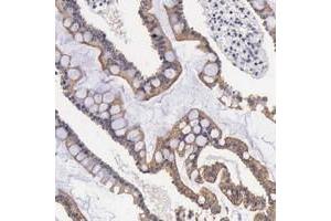 Immunohistochemical staining of human duodenum with FAM109B polyclonal antibody  shows moderate cytoplasmic and membranous positivity in glandular cells. (FAM109B 抗体)