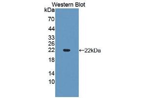 Western blot analysis of the recombinant protein. (SLIT3 抗体  (AA 1405-1512))