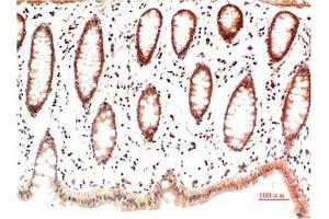 Immunohistochemistry (IHC) image for anti-Collagen, Type I, alpha 1 (COL1A1) antibody (ABIN7189550)
