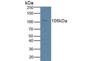 Detection of RB1 in Human Serum using Polyclonal Antibody to Retinoblastoma Protein 1 (RB1) (Retinoblastoma 1 抗体  (AA 639-778))