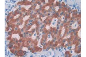 DAB staining on IHC-P; Samples: Rat Pancreas Tissue (IL1A 抗体  (AA 115-270))