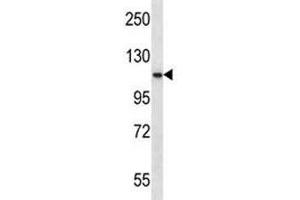 Western Blotting (WB) image for anti-Proprotein Convertase Subtilisin/kexin Type 6 (PCSK6) (AA 659-688) antibody (ABIN3032337)