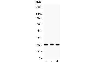 Western blot testing of MGMT antibody and human samples 1:  HeLa;  2: placenta;  3: Jurkat. (MGMT 抗体  (AA 2-207))