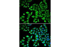 Immunofluorescence (IF) image for anti-C-Reactive Protein (CRP) (AA 1-224) antibody (ABIN3020716) (CRP 抗体  (AA 1-224))
