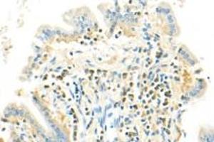 Immunohistochemistry analysis of paraffin-embedded mouse colon using SLK (ABIN7075729) at dilution of 1: 500 (SLK 抗体)