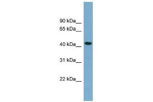 CDCA7L antibody used at 1 ug/ml to detect target protein. (CDCA7L 抗体  (Middle Region))