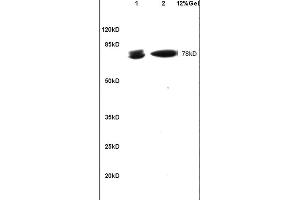 SDS-PAGE (SDS) image for anti-B-Cell CLL/lymphoma 6 (BCL6) (AA 501-600) antibody (ABIN749843)