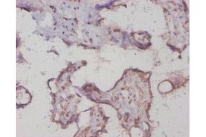 Immunohistochemistry of paraffin-embedded human placenta tissue using ABIN7154210 at dilution of 1:20 (PYGL 抗体  (AA 2-846))