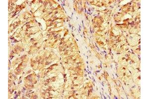 Immunohistochemistry of paraffin-embedded human adrenal gland tissue using ABIN7144308 at dilution of 1:100 (Anoctamin 4 抗体  (AA 1-200))