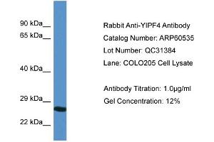 Western Blotting (WB) image for anti-Yip1 Domain Family, Member 4 (YIPF4) (N-Term) antibody (ABIN2788486) (YIPF4 抗体  (N-Term))