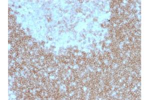 Formalin-fixed, paraffin-embedded human Tonsil stained with CD268 / BAFFR Mouse Monoclonal Antibody (BAFFR/1557). (TNFRSF13C 抗体)