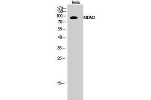 Western Blotting (WB) image for anti-Mdm2, p53 E3 Ubiquitin Protein Ligase Homolog (Mouse) (MDM2) (Ser880) antibody (ABIN3180170) (MDM2 抗体  (Ser880))