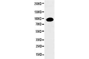 Anti-PKC alpha antibody, Western blottingWB: HELA Cell Lysate (PKC alpha 抗体  (N-Term))