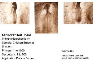 Sample Type: Chicken EmbryosDilution: 1:1000 (Sonic Hedgehog 抗体  (N-Term))