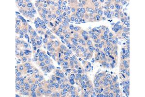 Immunohistochemistry (IHC) image for anti-Potassium Voltage-Gated Channel, Subfamily H (Eag-Related), Member 8 (KCNH8) antibody (ABIN2431491) (KCNH8 抗体)