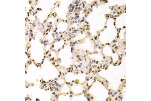 Immunohistochemistry of paraffin-embedded rat lung using SFN antibody at dilution of 1:100 (x400 lens). (14-3-3 sigma/SFN 抗体)