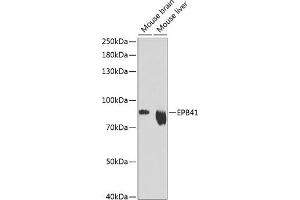 Western blot analysis of extracts of various cell lines, using EPB41 Antibody (ABIN6132258, ABIN6140197, ABIN6140198 and ABIN6216056) at 1:1000 dilution. (EPB41 抗体  (AA 210-500))