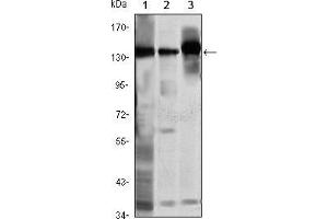 Western blot analysis using SMC1 mouse mAb against K562 (1), Jurkat (2) and A549 (3) cell lysate. (SMC1A 抗体)