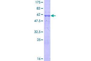 MAD2L1BP Protein (AA 1-306) (GST tag)