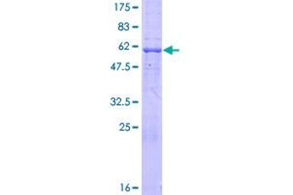 MAD2L1BP Protein (AA 1-306) (GST tag)