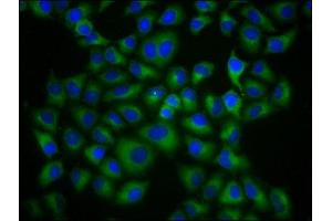 Immunofluorescence staining of Hela cells with ABIN7155551 at 1:133, counter-stained with DAPI.